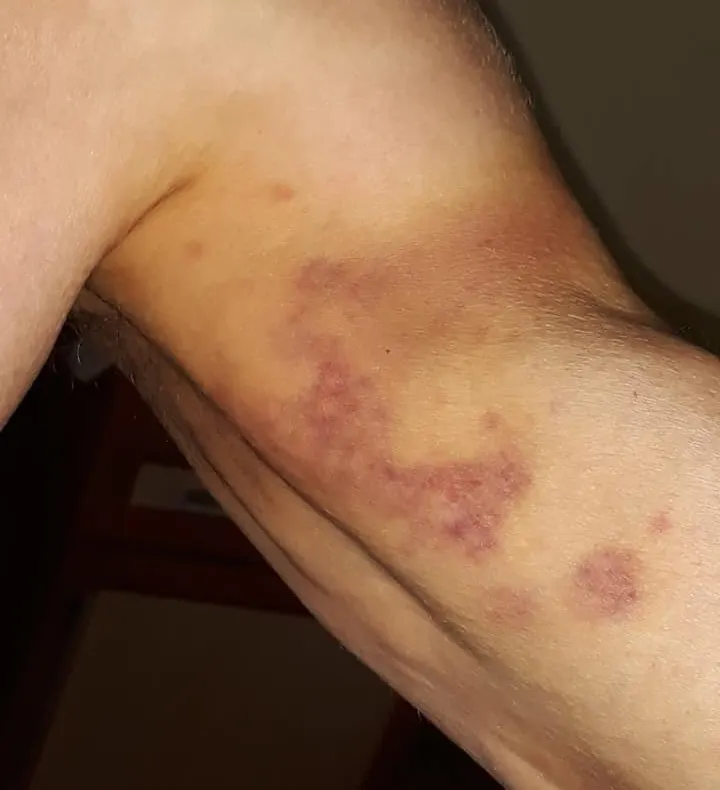 Anchetă la Spitalul Municipal Sighetu Marmației după ce un bătrân ar fi fost bătut