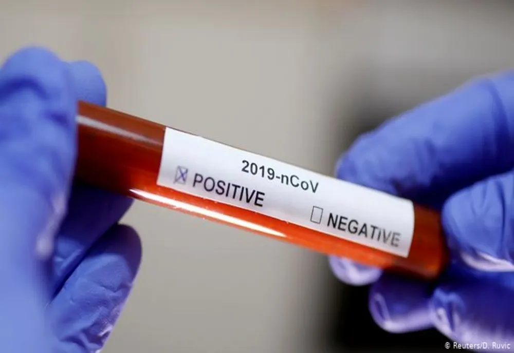 CORONAVIRUS: 246 de noi cazuri de îmbolnăvire