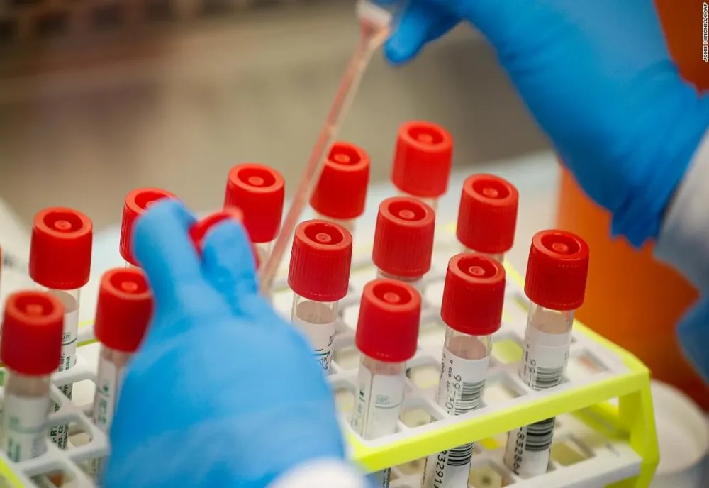 Un nou caz de coronavirus în județul Maramureș