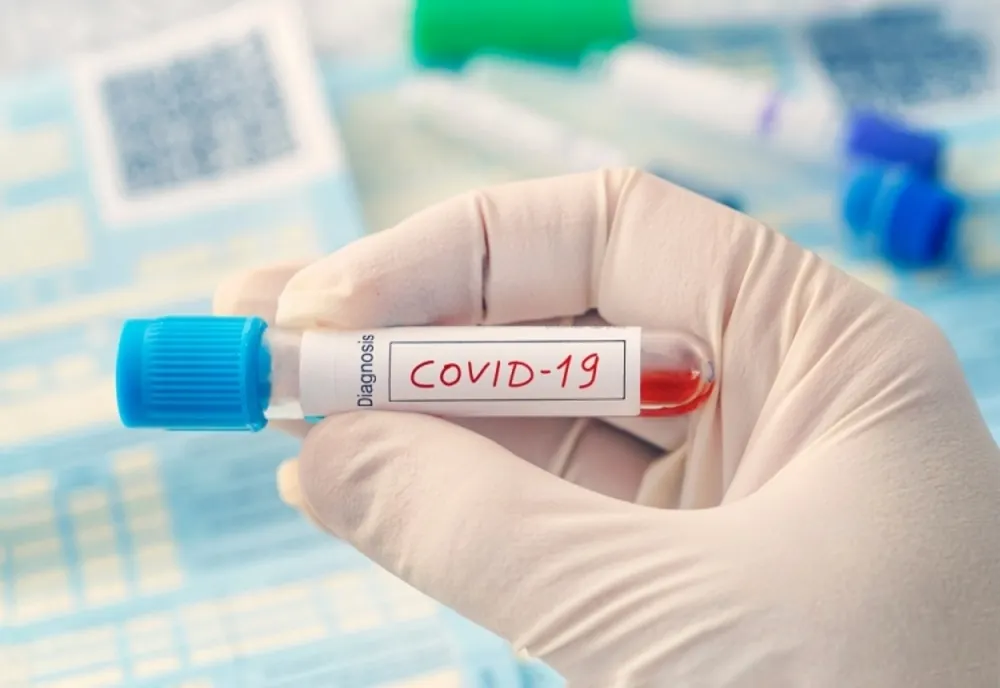 Șase angajați ai Primăriei Recea, infectați cu SARS-CoV-2