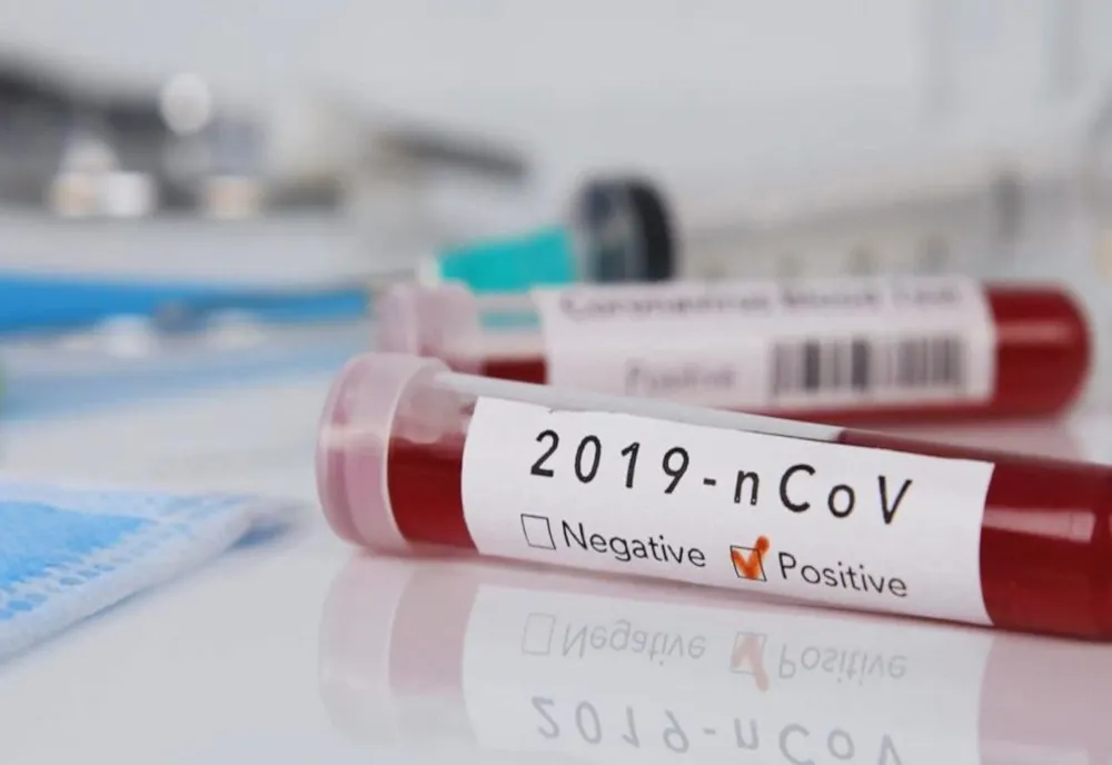 CORONAVIRUS: 143 de noi cazuri de îmbolnăvire și 5 decese