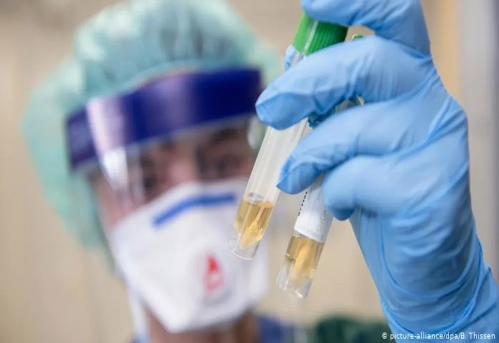 44 de persoane diagnosticate cu noul coronavirus au decedat