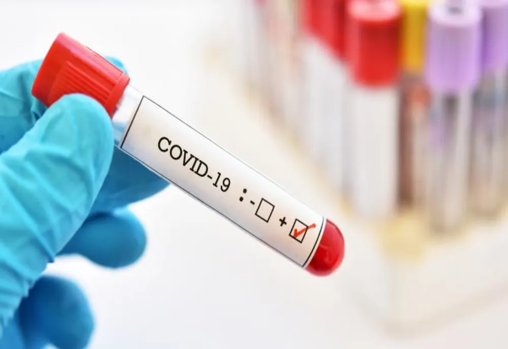CORONAVIRUS: În ultimele 24 de ore au fost înregistrate alte 306 de noi cazuri de îmbolnăvire