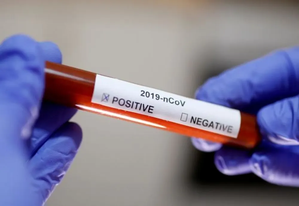 Bilanț coronavirus 31 ianuarie: 20.131 cazuri noi și 41 decese