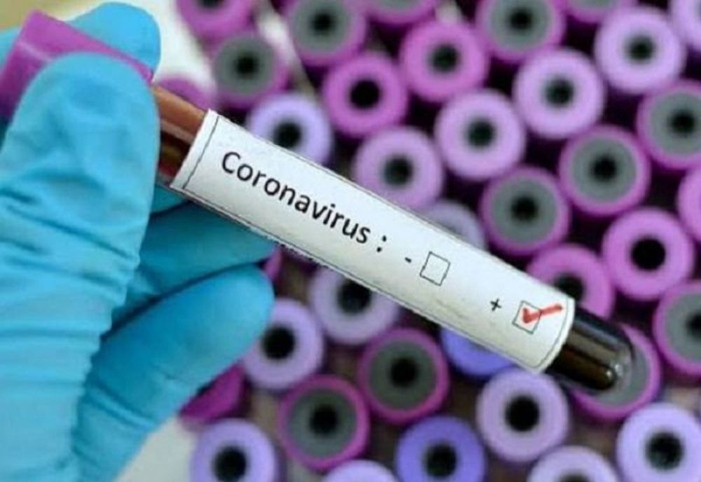 CE TREBUIE SĂ ȘTIȚI DESPRE NOUL CORONAVIRUS: 10 elemente comportamentale care trebuiesc urmate