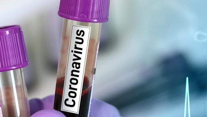 Coronavirus-Vial-Generic-Pixabay_16beccccee