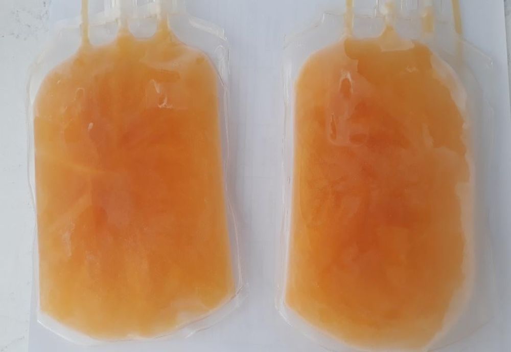 Un pacient vindecat de CoVid-19 a donat plasmă în județul Maramureș! Apelul Centrului de Transfuzie Sanguină