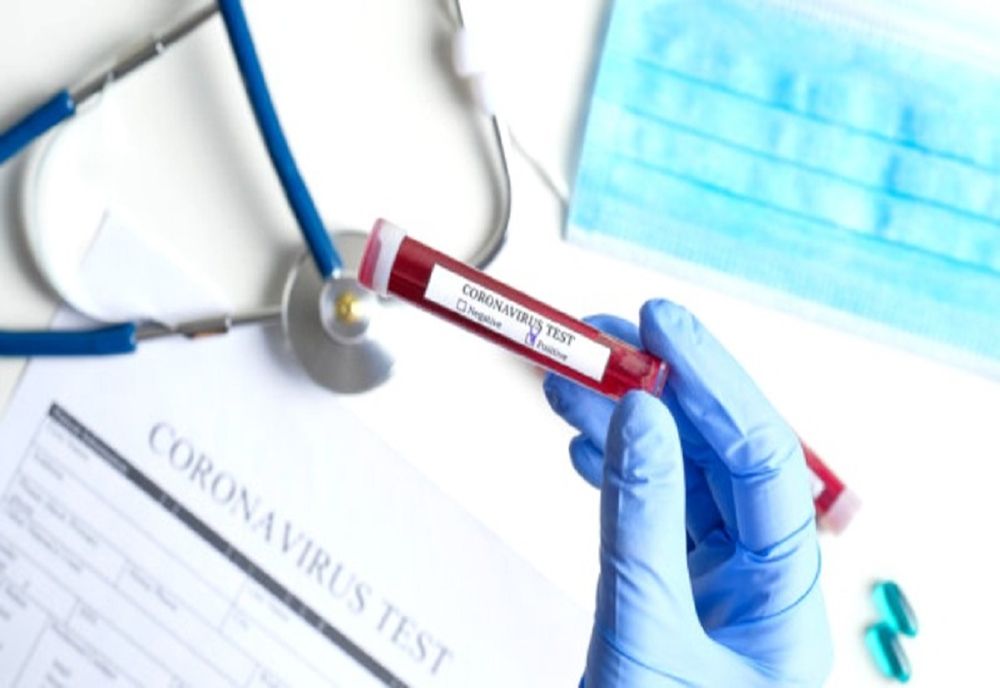 Bilanț coronavirus 15 noiembrie: 2.136 cazuri noi, 195 decese