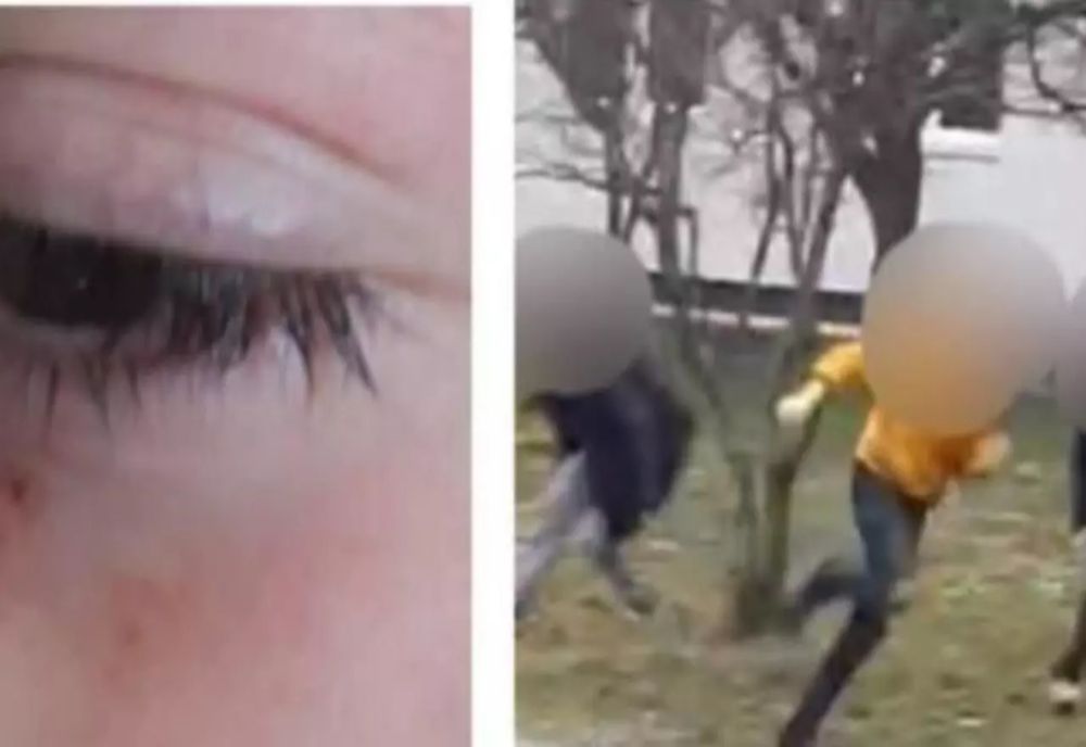 Un elev de 12 ani a fost lovit de două colege, la o școală din Maramureș