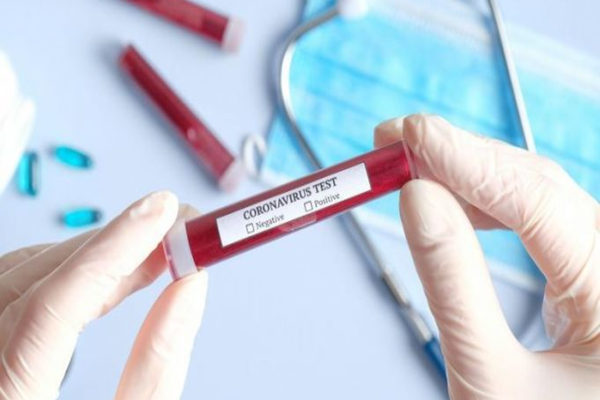 Bilant coronavirus ROMÂNIA, 26 iulie. 1120 de cazuri noi în ultimele 24 de ore și 22 de decese