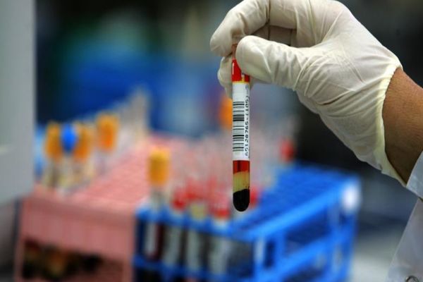 Noi condiții pentru donarea de sânge total/plasmă de la persoanele vindecate de COVID 19