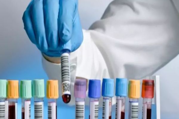 Analize medicale gratuite pentru români, de la 1 iulie. Lista, suplimentată