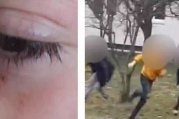 Un elev de 12 ani a fost lovit de două colege, la o școală din Maramureș