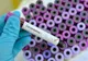 Pompier maramureșean, confirmat cu noul coronavirus