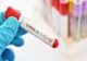 CORONAVIRUS: În ultimele 24 de ore au fost înregistrate alte 306 de noi cazuri de îmbolnăvire