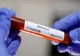 CORONAVIRUS: 246 de noi cazuri de îmbolnăvire