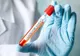 Un nou caz de coronavirus a fost confirmat în județul Maramureș
