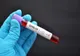 Șase angajați ai unei primării din Maramureș au fost confirmați pozitiv cu coronavirus. Primăria a fost declarată focar de infecție cu SARS-CoV-2
