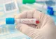 Șase angajați ai Primăriei Recea, infectați cu SARS-CoV-2