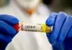 Medlife a depistat încă 45 de cazuri de infectare cu tulpina britanică, din 90 de probe analizate!