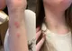 Condiții jalnice în trenul București–Sighet. O tânără a ajuns la spital după ce a fost mușcată de ploșnițe într-un vagon cușetă